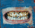 Gold Teeth <span>🔴</span>